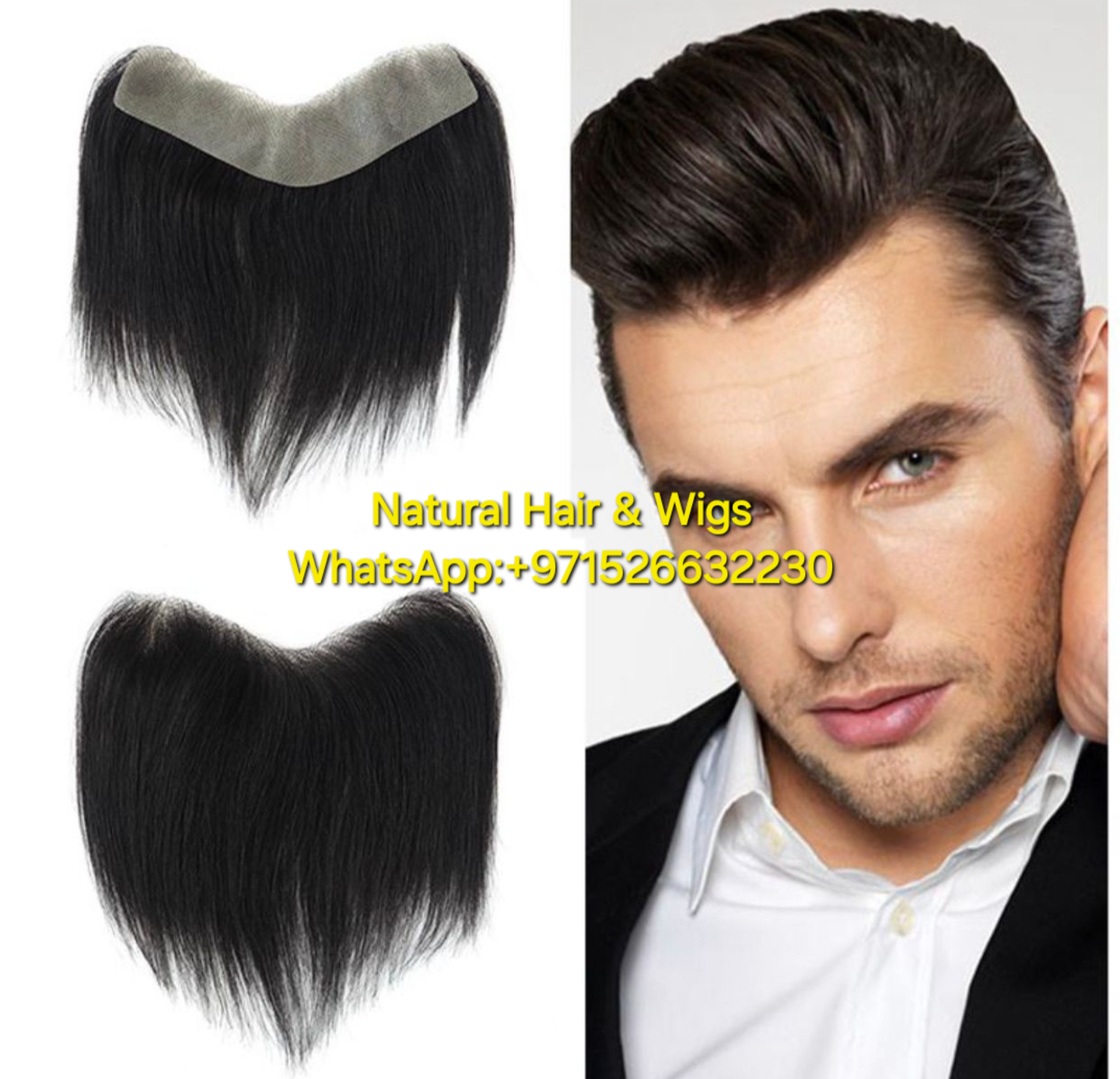 Front Line Hair Patch for Men Front Line Hair Fixing In Dubai - Natural Hair and Wigs
