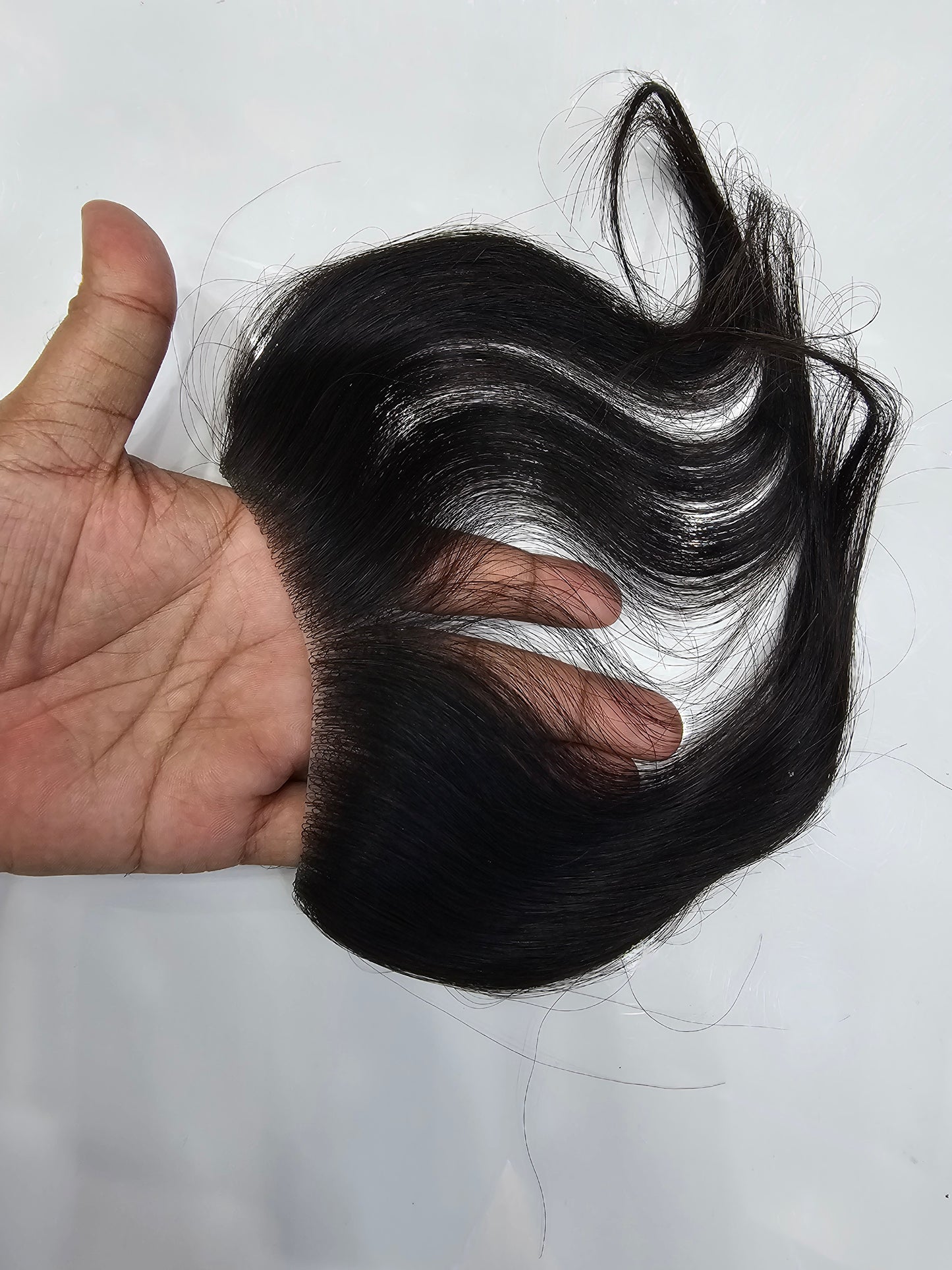 men who loss forehead hair
